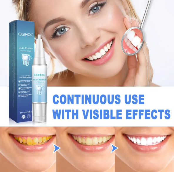 Teeth Repair Gel by My Store 4