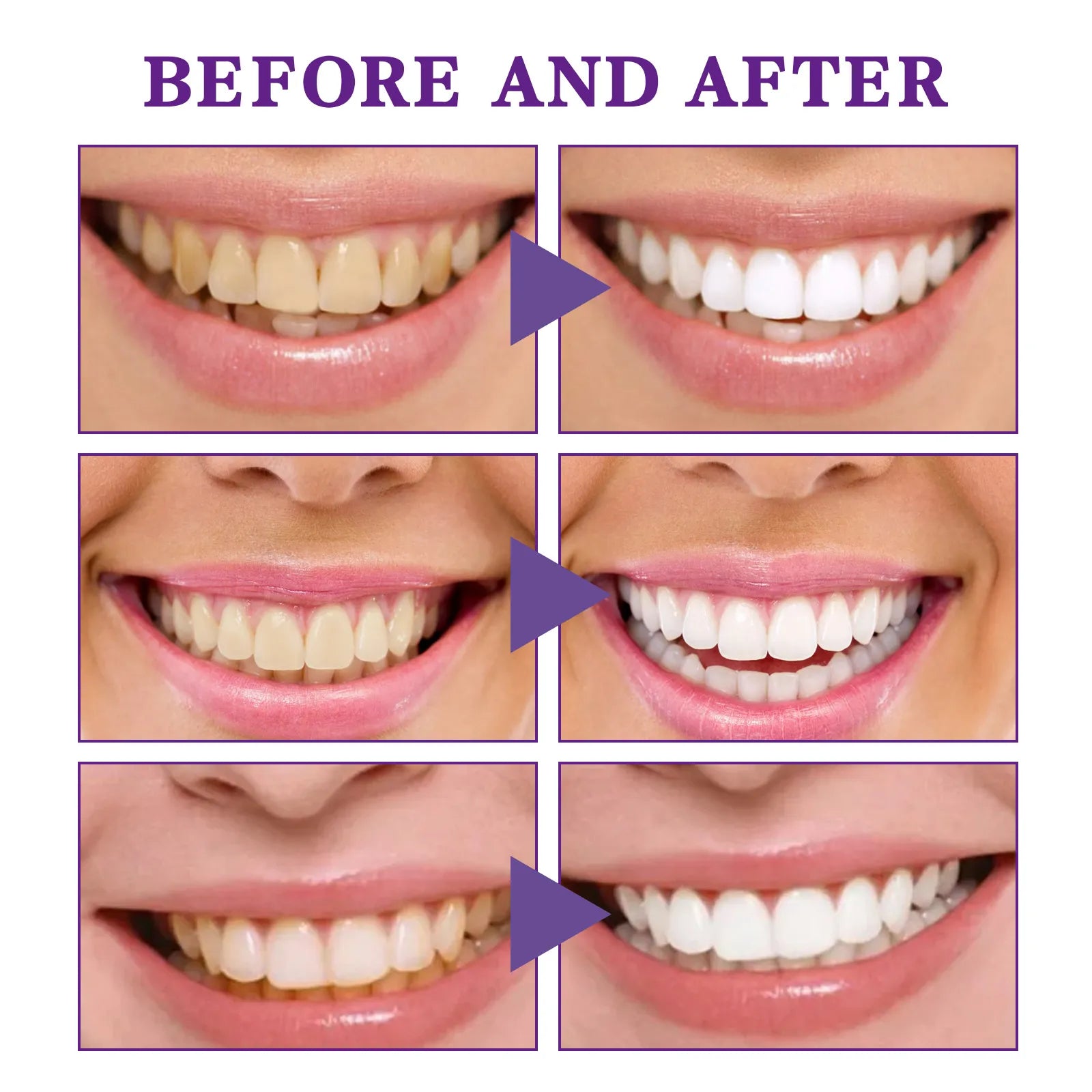 V34 Tooth Cleaning Mousse by My Store 4