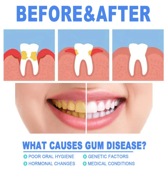 Teeth Repair Gel by My Store 4