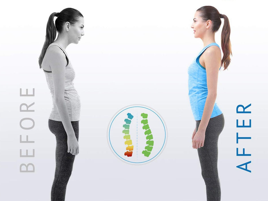 Posture Corrector by My Store 4