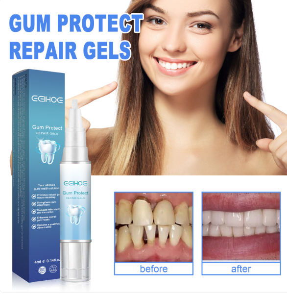 Teeth Repair Gel by My Store 4